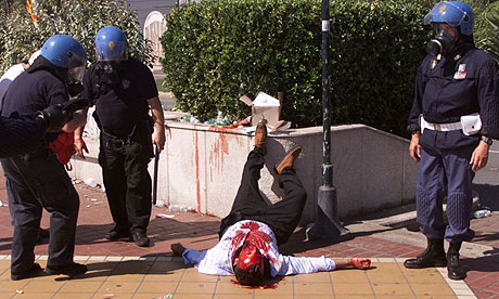 A protester in Genoa, 2001 at the G8 protests after a severe police beating.