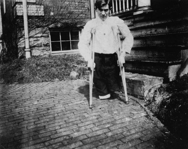 Nola McKinney, whose legs were cut off by a motor car in a coal mine when he was 14- West Virginia 1910credit to Lewis Hine