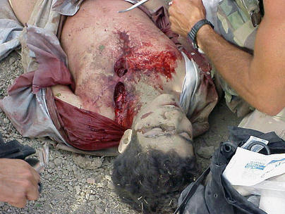 Omar Khadr, ferito (più morto che vivo)