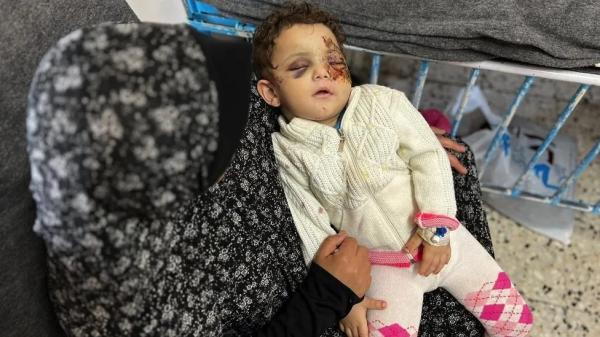 Muna Alwan, una bambina di due anni, ha perso i genitori, il fratello e il nonno in un attacco aereo nel nord di Gaza