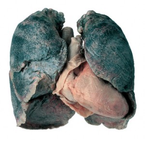 Black Lung disease‎