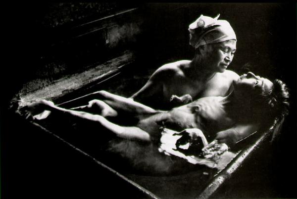 La foto forse più famosa sugli effetti dell'avvelenamento da metilmercurio a danno degli abitanti della baia di Minamata. S'intitola "Tomoko Uemura in Her Bath, Minamata" e fa parte di un celebre servizio realizzato nel 1972 dal grande fotografo americano William Eugene Smith (1918-1978). 