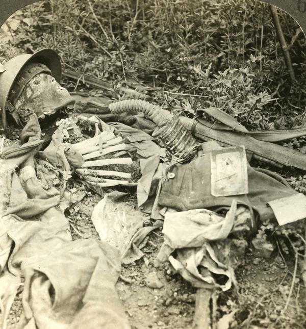 The Decomposing Body of a British Soldier Killed During World War I